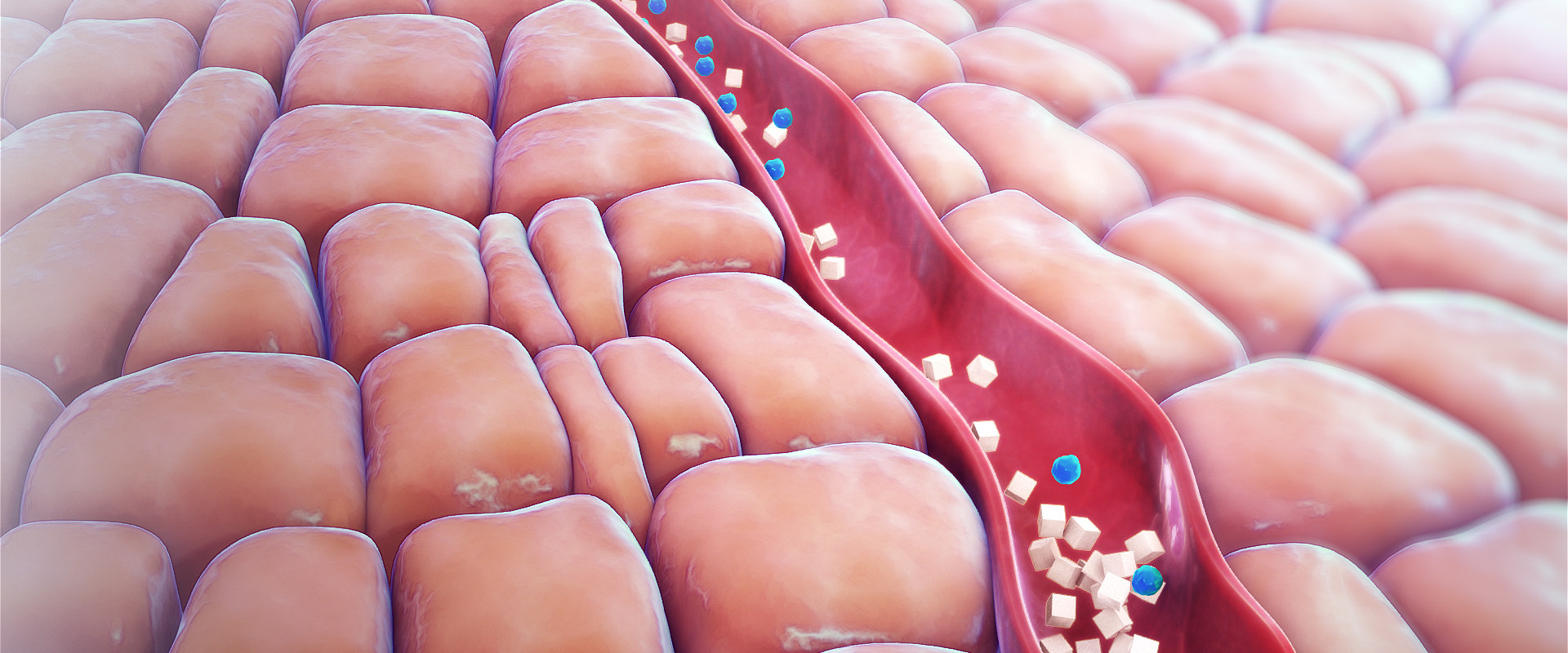 Understanding the Causes of Hypoglycemia